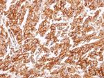 CYSLTR1 Polyclonal Antibody