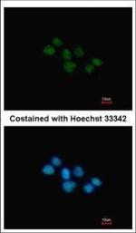 NR1D1 Polyclonal Antibody