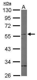 RORB Antibody in Western Blot (WB)