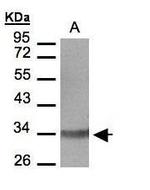 LTB4R Antibody in Western Blot (WB)