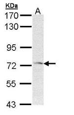 FZD1 Antibody in Western Blot (WB)