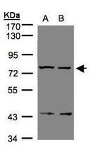 LGR7 Polyclonal Antibody