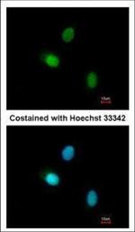 HUNK Polyclonal Antibody