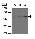 mGluR6 Antibody in Western Blot (WB)