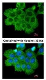 ROCK2 Polyclonal Antibody