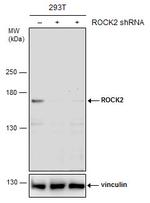 ROCK2 Antibody in Western Blot (WB)