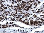 Histone H2A.X Antibody in Immunohistochemistry (Paraffin) (IHC (P))