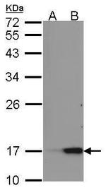 REG3A Polyclonal Antibody