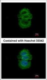 alpha TTP Polyclonal Antibody