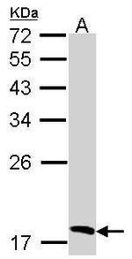 Flavin reductase Polyclonal Antibody