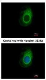 eRF1 Polyclonal Antibody