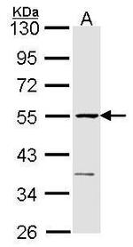 eRF1 Antibody in Western Blot (WB)