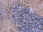 eRF1 Antibody in Immunohistochemistry (Paraffin) (IHC (P))
