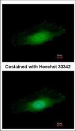 PPP4C Antibody in Immunocytochemistry (ICC/IF)
