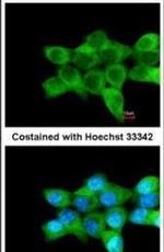 CERT Antibody in Immunocytochemistry (ICC/IF)