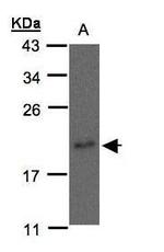 NME3 Polyclonal Antibody