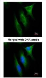 NME1 Antibody in Immunocytochemistry (ICC/IF)