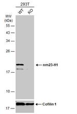 NME1 Antibody in Western Blot (WB)