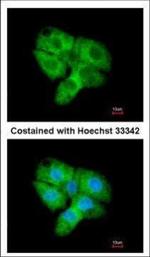 CDK5 Polyclonal Antibody