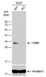CDK5 Antibody in Western Blot (WB)