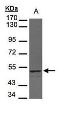 UHMK1 Antibody in Western Blot (WB)