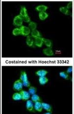 CERT Antibody in Immunocytochemistry (ICC/IF)