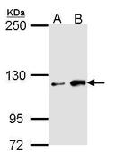 HIPK1 Antibody in Western Blot (WB)