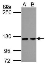 HIPK1 Antibody in Western Blot (WB)
