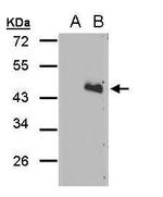 DRICH1 Polyclonal Antibody