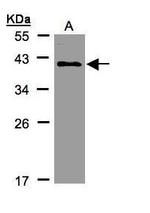 KLHDC8A Polyclonal Antibody