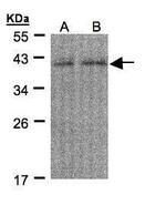 REXO4 Antibody in Western Blot (WB)