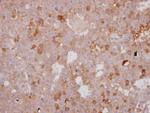 beta-1 Adrenergic Receptor Antibody in Immunohistochemistry (Paraffin) (IHC (P))