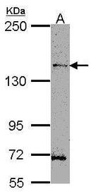 HIPK3 Polyclonal Antibody