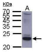 Hepatitis B Small S Protein Antibody in Western Blot (WB)