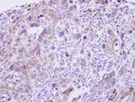 GDF5 Polyclonal Antibody