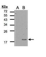 IL1F5 Polyclonal Antibody