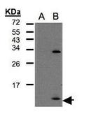 CXCL1 Polyclonal Antibody