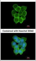 CHRND Antibody in Immunocytochemistry (ICC/IF)
