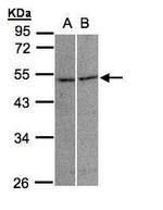 GLRA3 Polyclonal Antibody