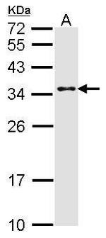 CRSP9 Polyclonal Antibody