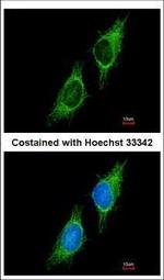 P2X2 Polyclonal Antibody