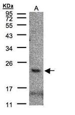 CMTM3 Polyclonal Antibody