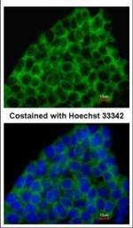 BMP-8A Polyclonal Antibody