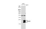 GPX7 Antibody in Western Blot (WB)