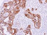 RAB5 Antibody in Immunohistochemistry (Paraffin) (IHC (P))