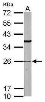 RAB5 Antibody in Western Blot (WB)