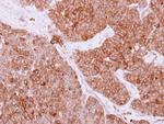 Rab4 Polyclonal Antibody