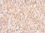 EphB4 Antibody in Immunohistochemistry (Paraffin) (IHC (P))