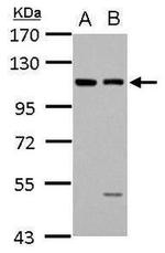 EphB4 Antibody in Western Blot (WB)