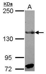 RFX1 Antibody in Western Blot (WB)